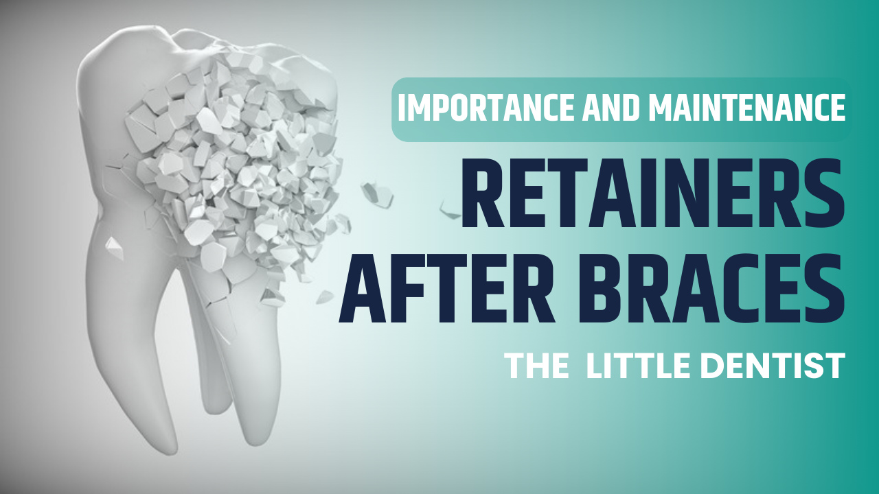 Retainers After Braces: Importance and Maintenance