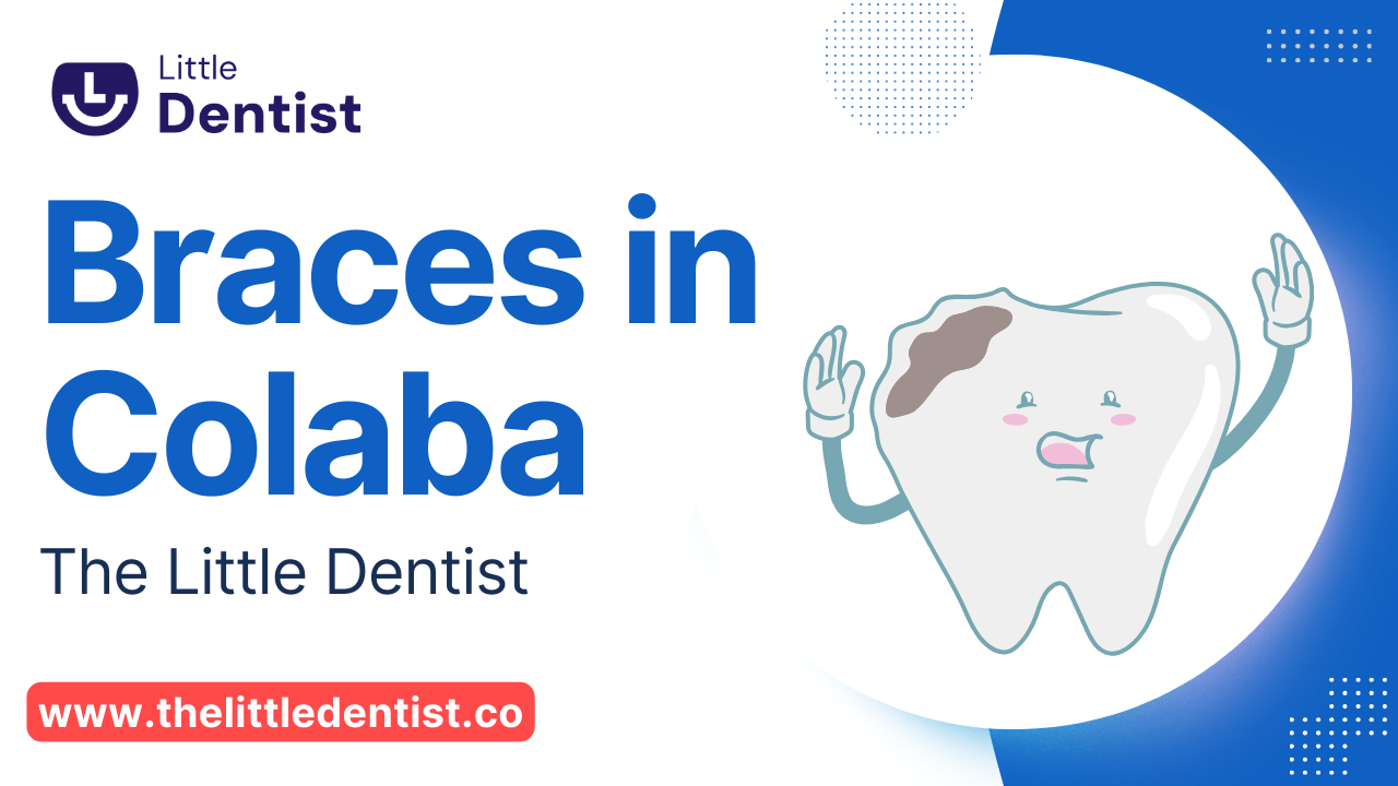 Braces in Colaba: The Little Dentist's Smile Makeover Revolution