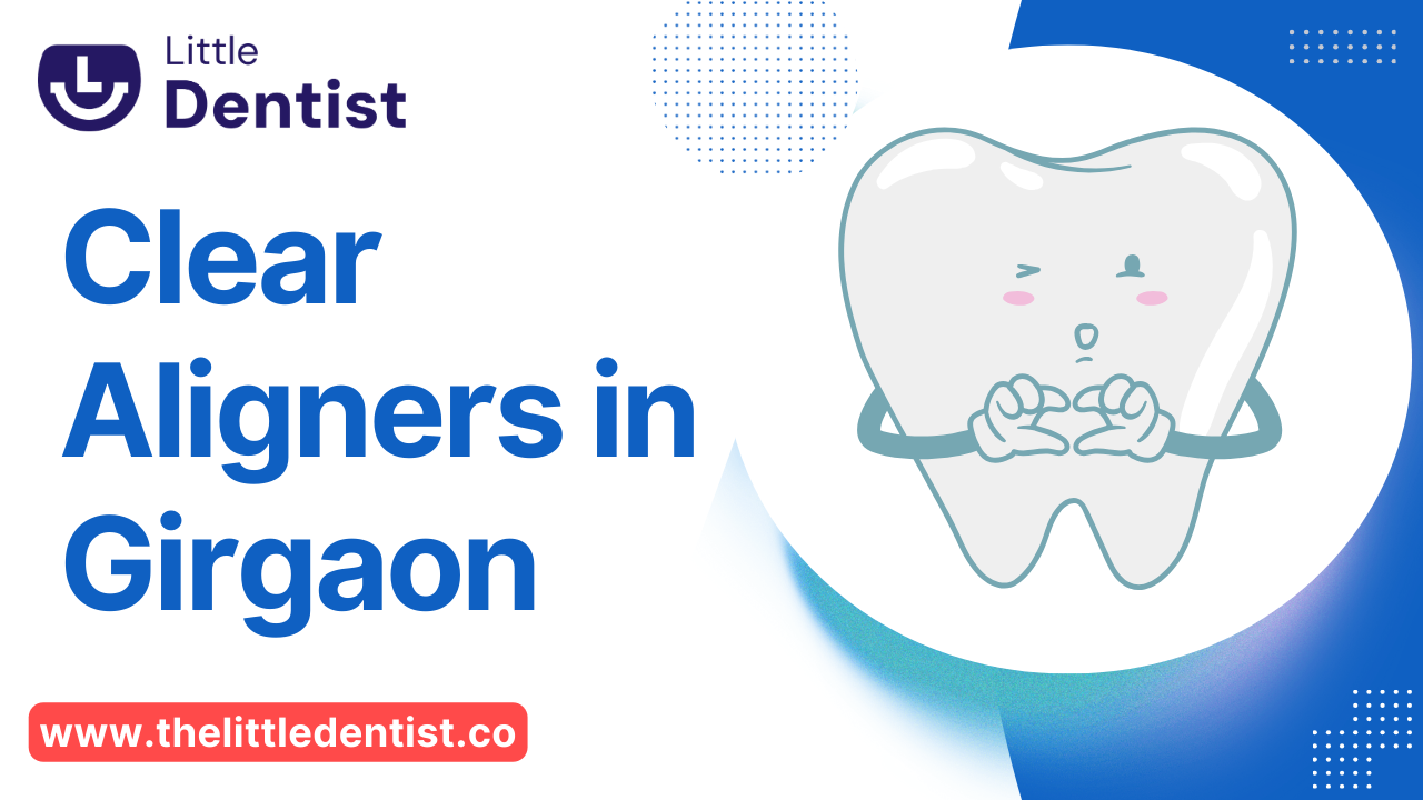 Clear Aligners in Girgaon: A Revolution in Orthodontic Treatment