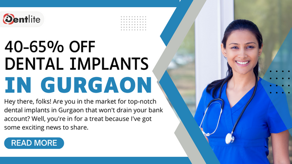 Dental Implants in Gurgaon